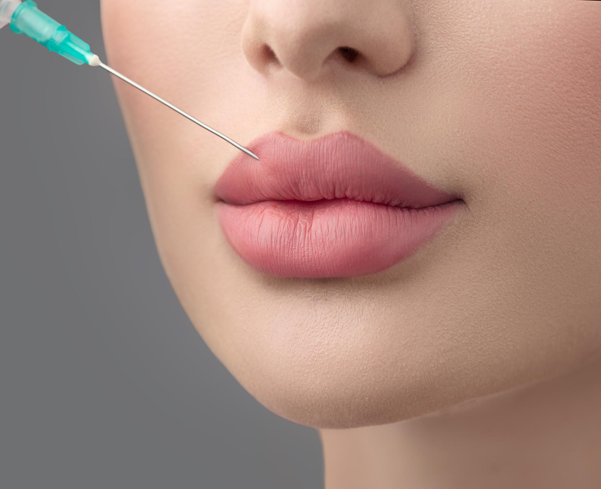 Facial Fillers In Dubai Omni Care